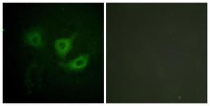 Immunofluorescence analysis of HUVEC cells using Anti-p70 S6 Kinase (phospho Thr389) Antibody. The right hand panel represents a negative control, where the antibody was pre-incubated with the immunising peptide