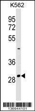 Anti-NRIP2 Rabbit Polyclonal Antibody (Biotin)