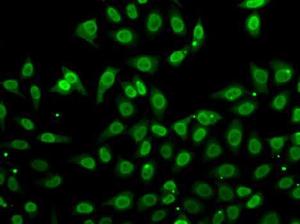 Immunofluorescence analysis of A549 cells using Anti-Grancalcin Antibody (A12070)