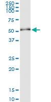 Anti-CK20 Rabbit Polyclonal Antibody