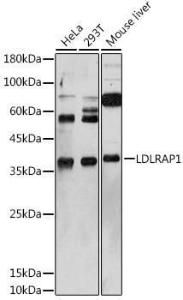 Anti-ARH Rabbit Polyclonal Antibody