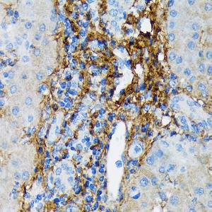 Immunohistochemistry analysis of paraffin-embedded human liver using Anti-Collagen VI Antibody [ARC1725] (A305599) at a dilution of 1:100 (40x lens). Perform microwave antigen retrieval with 10 mM Tris/EDTA buffer pH 9.0 before commencing with IHC staining protocol.