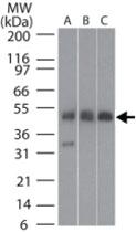 Anti-TUBB2A Rabbit Polyclonal Antibody