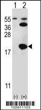 Anti-UBE2I Rabbit Polyclonal Antibody (PE (Phycoerythrin))