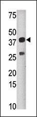 Anti-SULT1C2 Rabbit Polyclonal Antibody