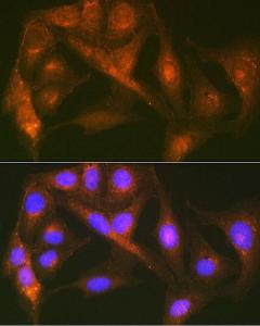 Immunofluorescence analysis of U-2 OS cells using Anti-Cortactin Antibody [ARC1613] (A307999) at a dilution of 1:100 (40x lens). DAPI was used to stain the cell nuclei (blue).