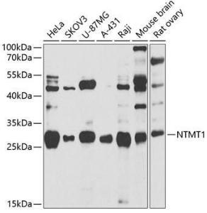 Western blot analysis of extracts of various cell lines, using Anti-METTL11A Antibody (A12072) at 1:1000 dilution