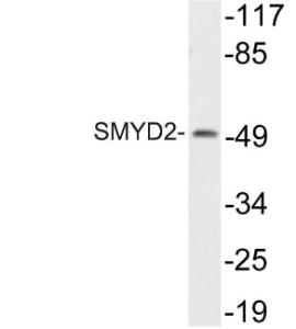 Western blot analysis of lysate from HT29 cells using Anti-SMYD2 Antibody