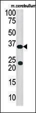 Anti-SULT4A1 Rabbit Polyclonal Antibody (AP (Alkaline Phosphatase))