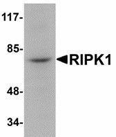 Anti-RIPK1 Rabbit Polyclonal Antibody