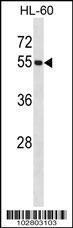 Anti-UBA3 Rabbit Polyclonal Antibody