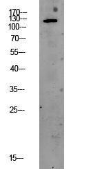 Western blot analysis of CACO2 lysate using Anti-PERK Antibody