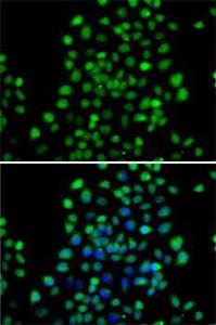 Immunofluorescence analysis of A-549 cells using Anti-METTL11A Antibody (A12072). DAPI was used to stain the cell nuclei (blue)