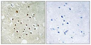 Anti-RPS19BP1 antibody