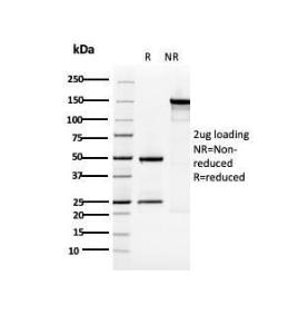 Anti-Cytokeratin 5 Mouse Monoclonal Antibody [clone: KRT5/3594]