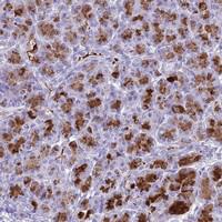 Anti-BEST2 Rabbit Polyclonal Antibody