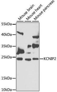 Anti-KChIP2 Rabbit Polyclonal Antibody