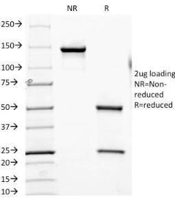 SDS-PAGE analysis of Anti-CD7 Antibody [SPV-L14] under non-reduced and reduced conditions; showing intact IgG and intact heavy and light chains, respectively. SDS-PAGE analysis confirms the integrity and purity of the antibody