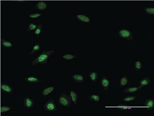 Anti-OLIG2 Mouse Monoclonal Antibody [clone: 3C9]