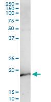 Anti-NEUROG3 Antibody Pair