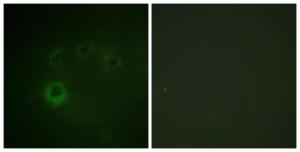 Immunofluorescence analysis of COS7 cells using Anti-p70 S6 Kinase (phospho Ser418) Antibody. The right hand panel represents a negative control, where the antibody was pre-incubated with the immunising peptide