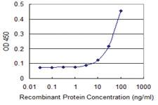 Anti-SEMA4A Mouse Monoclonal Antibody [clone: 4E2]