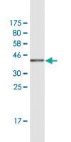 Anti-HEY2 Mouse Monoclonal Antibody [clone: 2B10]