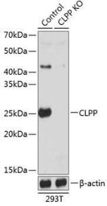 Western blot analysis of extracts from normal (control) and CLPP knockout (KO) 293T cells, using Anti-CLPP Antibody (A308001) at 1:1,000 dilution The secondary antibody was Goat Anti-Rabbit IgG H&L Antibody (HRP) at 1:10,000 dilution Lysates/proteins were present at 25 µg per lane