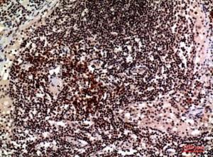 Immunohistochemical analysis of paraffin-embedded human lymph using Anti-CD244 Antibody