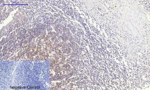 Immunohistochemical analysis of paraffin-embedded human Tonsil tissue using Anti-PERK Antibody at 1:200 (4 °C overnight). Negative control was secondary antibody only