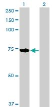 Anti-ACOX2 Rabbit Polyclonal Antibody