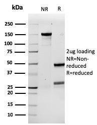 SDS-PAGE analysis of Anti-G-CSF Antibody [rCSF3/900] under non-reduced and reduced conditions; showing intact IgG and intact heavy and light chains, respectively. SDS-PAGE analysis confirms the integrity and purity of the antibody