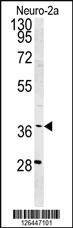 Anti-GRXCR1 Rabbit Polyclonal Antibody