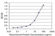 Anti-GTF3A Mouse Monoclonal Antibody [clone: 4G4]