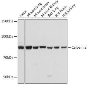 Western blot analysis of extracts of various cell lines, using Anti-Calpain 2 Antibody [ARC0891] (A306767) at 1:1,000 dilution The secondary antibody was Goat Anti-Rabbit IgG H&L Antibody (HRP) at 1:10,000 dilution Lysates/proteins were present at 25 µg per lane