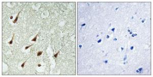 Anti-PKC thet antibody