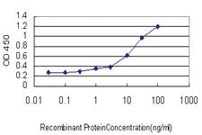 Anti-ASCL1 Mouse Monoclonal Antibody [clone: 1C5]