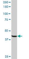 Anti-ACOX2 Rabbit Polyclonal Antibody