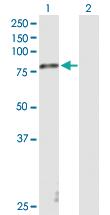 Anti-STRA6 Mouse Polyclonal Antibody