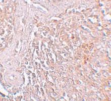 Anti-SLC39A8 Rabbit Polyclonal Antibody