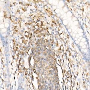 Immunohistochemistry analysis of paraffin-embedded human colon tissue using Anti-CMTM3 Antibody (A308002) at a dilution of 1:100 (40x lens). Perform high pressure antigen retrieval with 10 mM citrate buffer pH 6.0 before commencing with IHC staining protocol.