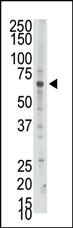 Anti-PAPSS2 Rabbit Polyclonal Antibody