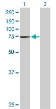 Anti-STRA6 Rabbit Polyclonal Antibody