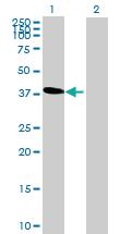 Anti-ARMC12 Mouse Polyclonal Antibody