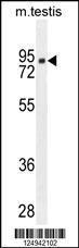 Anti-CLPX Rabbit Polyclonal Antibody