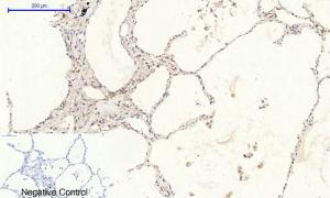 Immunohistochemical analysis of paraffin-embedded human lung tissue using Anti-PERK Antibody at 1:200 (4 °C overnight). Negative control was secondary antibody only