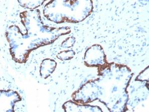 Immunohistochemical analysis of formalin-fixed, paraffin-embedded human prostate using Anti-Cytokeratin 5 Antibody [rKRT5/6398]