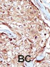 Anti-PAPSS2 Rabbit Polyclonal Antibody