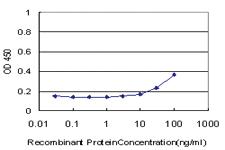 Anti-GTF3A Mouse Monoclonal Antibody [clone: 3A1]