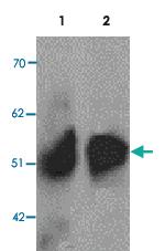 Anti-SLC39A8 Rabbit Polyclonal Antibody